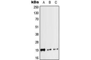 Western blot analysis of Calcitonin expression in HEK293T (A), mouse heart (B), rat heart (C) whole cell lysates. (Calcitonin anticorps  (Center))