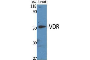 Western Blotting (WB) image for anti-Vitamin D Receptor (VDR) (Tyr307) antibody (ABIN3187461) (Vitamin D Receptor anticorps  (Tyr307))