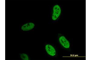 Immunofluorescence of monoclonal antibody to HEYL on HeLa cell.