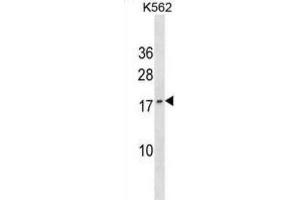 Western Blotting (WB) image for anti-GTP Cyclohydrolase I Feedback Regulator (GCHFR) antibody (ABIN3000608)