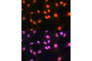 Immunofluorescence analysis of HeLa cells using KDM1 Polyclonal Antibody (ABIN7268323) at dilution of 1:100 (40x lens).