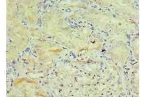Immunohistochemistry of paraffin-embedded human kidney tissue using ABIN7154113 at dilution of 1:100 (GSTO2 anticorps  (AA 124-243))