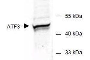 Image no. 2 for anti-Activating Transcription Factor 3 (ATF3) (AA 113-130) antibody (ABIN401262) (ATF3 anticorps  (AA 113-130))