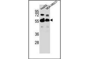 Western blot analysis of RAP1GDS1 Antibody  in HepG2,MDA-MB231 cell line lysates (35ug/lane). (RAP1GDS1 anticorps  (Middle Region))
