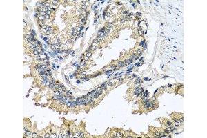 Immunohistochemistry of paraffin-embedded Human prostate using CST1 Polyclonal Antibody at dilution of 1:100 (40x lens). (CST1 anticorps)