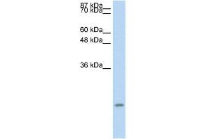 Western Blot showing CCL13 antibody used at a concentration of 1-2 ug/ml to detect its target protein.