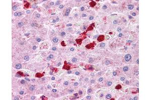 Anti-LRRC8B antibody IHC of human liver.