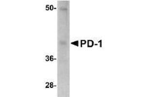 Western Blotting (WB) image for anti-Programmed Cell Death 1 (PDCD1) antibody (ABIN492542)