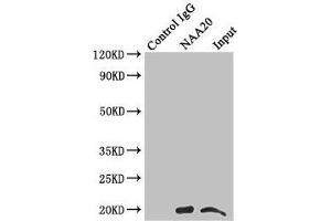 Immunoprecipitating NAA20 in Hela whole cell lysate Lane 1: Rabbit control IgG instead of (1 μg) instead of ABIN7160737 in Hela whole cell lysate. (NAT5 anticorps  (AA 49-178))