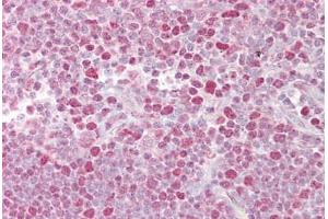 Anti-NFATC2 antibody IHC staining of human thymus.