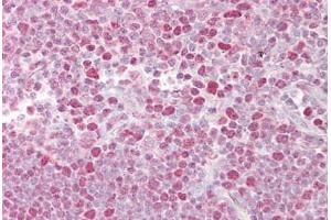 Anti-NFATC2 antibody IHC staining of human thymus.