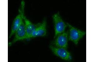 ICC/IF analysis of KLK3 in LNCap cells line, stained with DAPI (Blue) for nucleus staining and monoclonal anti-human KLK3 antibody (1:100) with goat anti-mouse IgG-Alexa fluor 488 conjugate (Green).