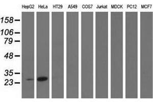 Western blot analysis of extracts (35 µg) from 9 different cell lines by using anti-GSTT2 monoclonal antibody. (GSTT2 anticorps)