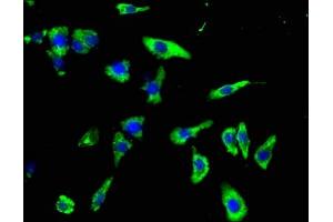 Immunofluorescence staining of HepG2 cells with ABIN7154398 at 1:100, counter-stained with DAPI.