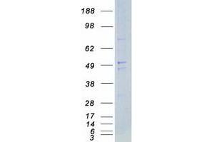 Validation with Western Blot