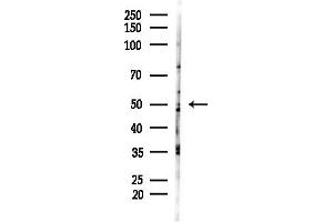 anti-Forkhead Box G1 (FOXG1) (C-Term) antibody