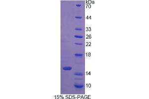 Image no. 1 for S100 Calcium Binding Protein A16 (S100A16) (AA 1-97) protein (His tag) (ABIN6237899)