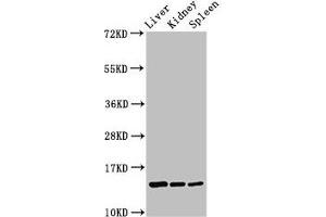 Western Blot Positive WB detected in: Rat liver tissue, Rat kidney tissue, Rat spleen tissue All lanes: CCDC26 antibody at 2. (CCDC26 anticorps  (AA 1-109))