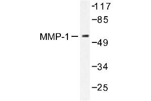 Image no. 1 for anti-Matrix Metallopeptidase 1 (Interstitial Collagenase) (MMP1) antibody (ABIN265522) (MMP1 anticorps)