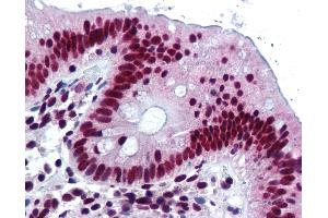 Anti-HNRNPK / hnRNP K antibody IHC of human colon. (HNRNPK anticorps)