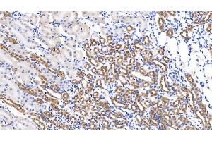 Detection of GPC1 in Mouse Kidney Tissue using Polyclonal Antibody to Glypican 1 (GPC1)