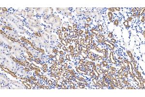 Detection of GPC1 in Mouse Kidney Tissue using Polyclonal Antibody to Glypican 1 (GPC1) (GPC1 anticorps  (AA 155-292))