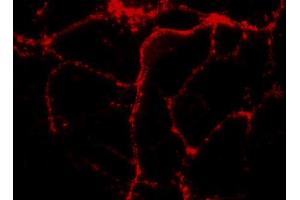 Immunocytochemistry on cultured hippocampus neurons (dilution 1 : 1000).