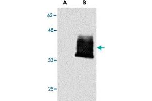 Western blot analysis of TNFRSF12A in (A) mock- and (B) TNFRSF12A-GPI-transfected 293 cells with TNFRSF12A polyclonal antibody  at 1 ug/mL .