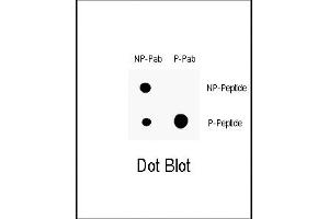 Dot blot analysis of anti-Phospho-P21CIP1- Antibody (ABIN389612 and ABIN2839616) on nitrocellulose membrane.