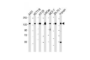 All lanes : Anti-MYO6 Antibody (C-term ) at 1:2000-1:8000 dilution Lane 1: A431 whole cell lysate Lane 2: HC whole cell lysate Lane 3: HT-29 whole cell lysate Lane 4: LNCap whole cell lysate Lane 5: MCF-7 whole cell lysate Lane 6: ZR-75-1 whole cell lysate Lane 7: Human brain lysate Lysates/proteins at 20 μg per lane. (Myosin VI anticorps  (C-Term))