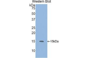 Western blot analysis of the recombinant protein. (GDF6 anticorps  (AA 339-454))