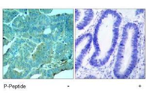 Image no. 1 for anti-Eukaryotic Translation Initiation Factor 2-alpha Kinase 2 (EIF2AK2) (pThr446) antibody (ABIN197048) (EIF2AK2 anticorps  (pThr446))