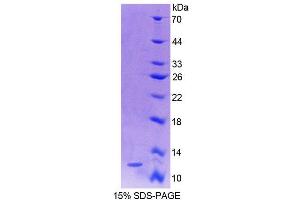 SDS-PAGE analysis of Human S100A4 Protein. (s100a4 Protéine)