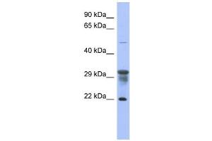 PMM1 antibody used at 1 ug/ml to detect target protein.
