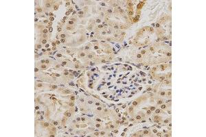 Immunohistochemistry of paraffin-embedded rat kidney using MDM2 antibody at dilution of 1:200 (x400 lens).