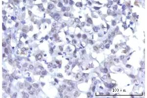 IHC analysis of RBM15B using anti-RBM15B antibody (ABIN7600219). (RBM15B anticorps  (AA 164-890))