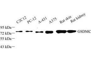 Western blot analysis of GSDMC (ABIN7074590) at dilution of 1: 50 (MLZE anticorps)