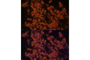 Immunofluorescence analysis of C6 cells using LRRC7 antibody (ABIN6128203, ABIN6143347, ABIN6143348 and ABIN6216986) at dilution of 1:100.