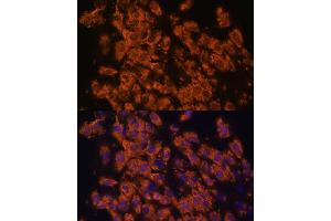 Immunofluorescence analysis of C6 cells using LRRC7 antibody (ABIN6128203, ABIN6143347, ABIN6143348 and ABIN6216986) at dilution of 1:100. (LRRC7 anticorps  (AA 730-890))