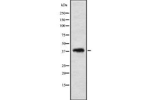 Western blot analysis of TF2A2 using K562 whole cell lysates (GTF2A2 anticorps  (Internal Region))