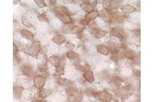 Immunohistochemical staining of pan synuclein in rat cochlear nucleus using Synuclein (pan) polyclonal antibody .