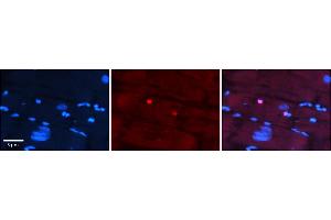 Rabbit Anti-IKZF4 Antibody    Formalin Fixed Paraffin Embedded Tissue: Human Adult heart  Observed Staining: Nuclear Primary Antibody Concentration: 1:100 Secondary Antibody: Donkey anti-Rabbit-Cy2/3 Secondary Antibody Concentration: 1:200 Magnification: 20X Exposure Time: 0. (IKZF4 anticorps  (N-Term))