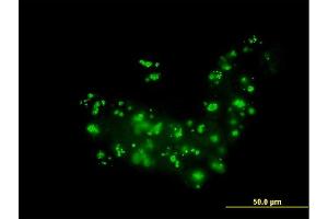 Immunofluorescence of monoclonal antibody to RAB36 on A-431 cell.