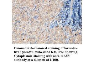 Image no. 1 for anti-Aminoadipate Semialdehyde Synthase (AASS) antibody (ABIN1574369) (AASS anticorps)