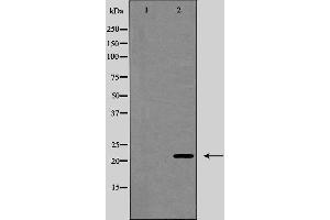 Western blot analysis of BIM expression in COS7 cells,The lane on the left is treated with the antigen-specific peptide.