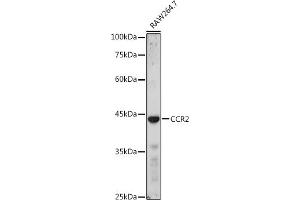 Western blot analysis of extracts of R. (CCR2 anticorps  (AA 315-374))