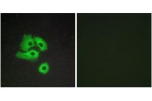 Immunofluorescence analysis of COS7 cells, using CCBP2 Antibody.