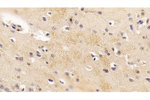 Detection of FGF2 in Rabbit Cerebrum Tissue using Polyclonal Antibody to Fibroblast Growth Factor 2, Basic (FGF2) (FGF2 anticorps  (AA 26-153) (APC))