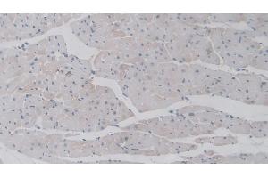 Detection of TNFaIP6 in Mouse Heart Tissue using Polyclonal Antibody to Tumor Necrosis Factor Alpha Induced Protein 6 (TNFaIP6)