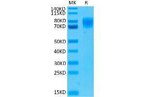 Biotinylated Human IFNAR1 on Tris-Bis PAGE under reduced conditions.